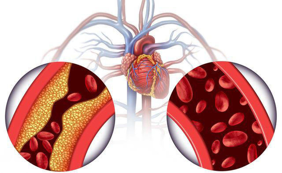 Dihydromyricetin da marca própria do OEM do pó 98% do dihydromyricetin do extrato do chá da videira do chá da videira