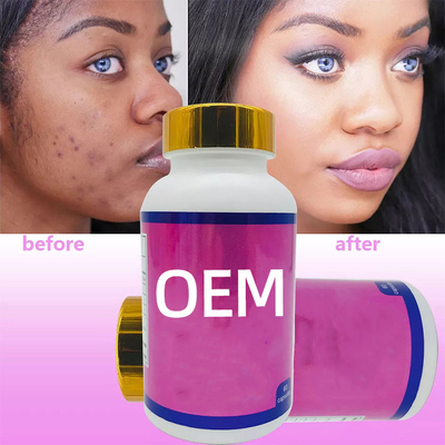 OEM Glutationa Pílulas de clareamento da pele 60pcs/Soft Gel